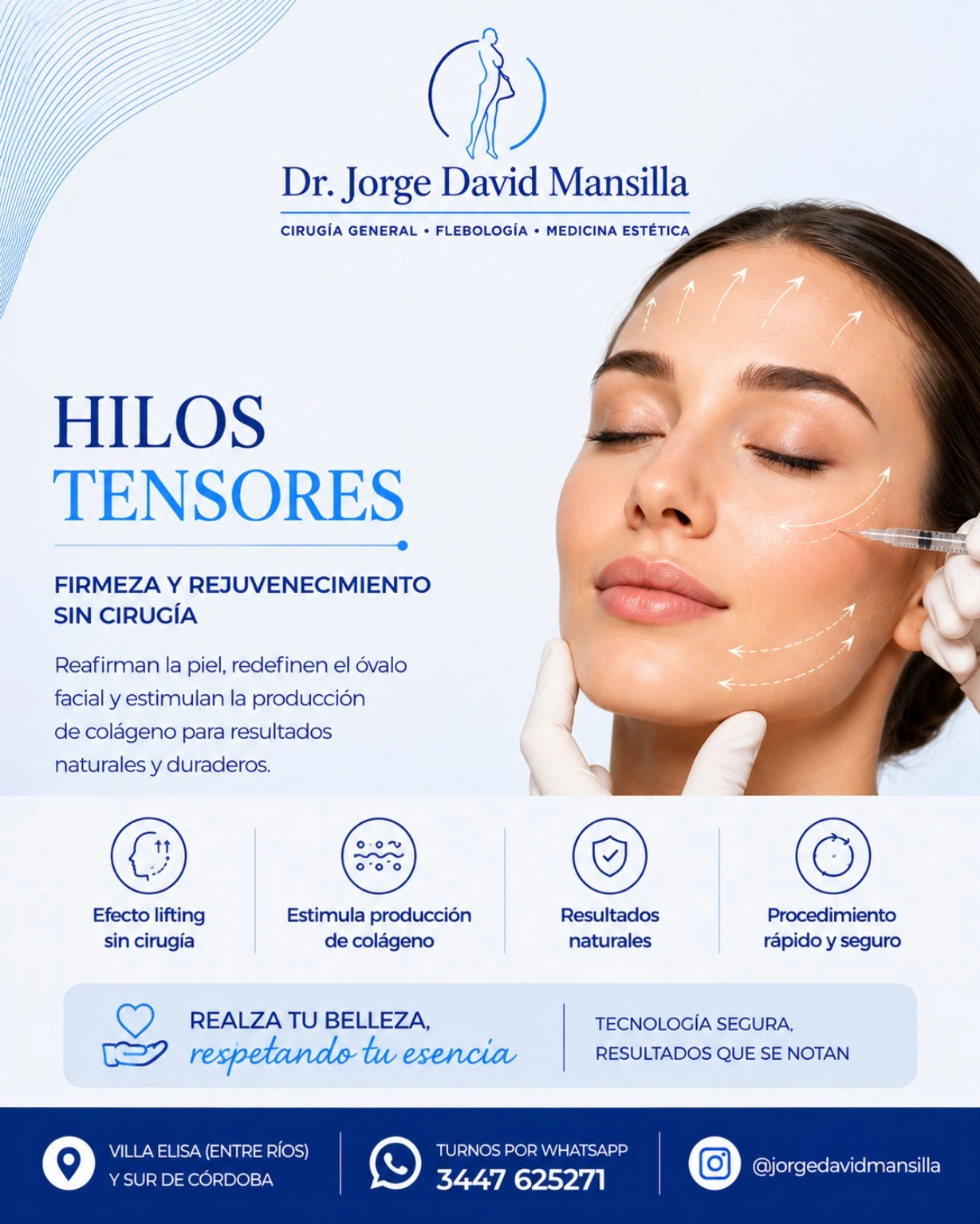 Hilos tensores