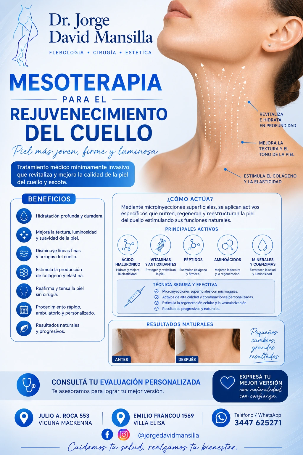 Mesoterapia para cuello