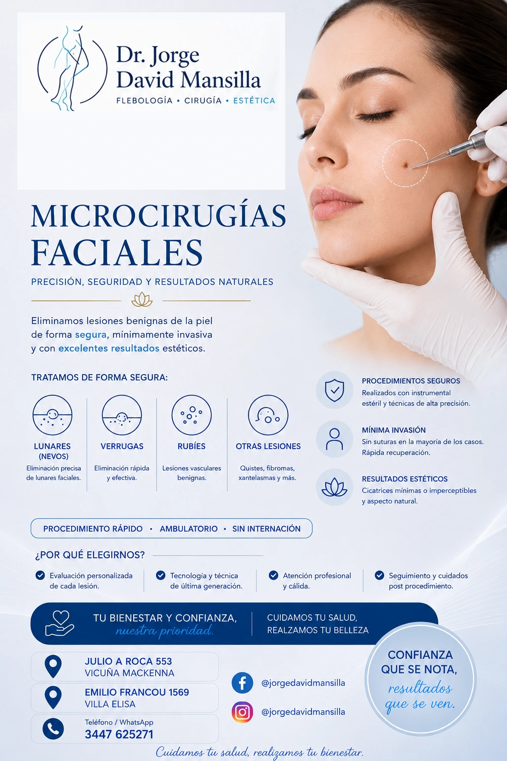 Microcirugías faciales