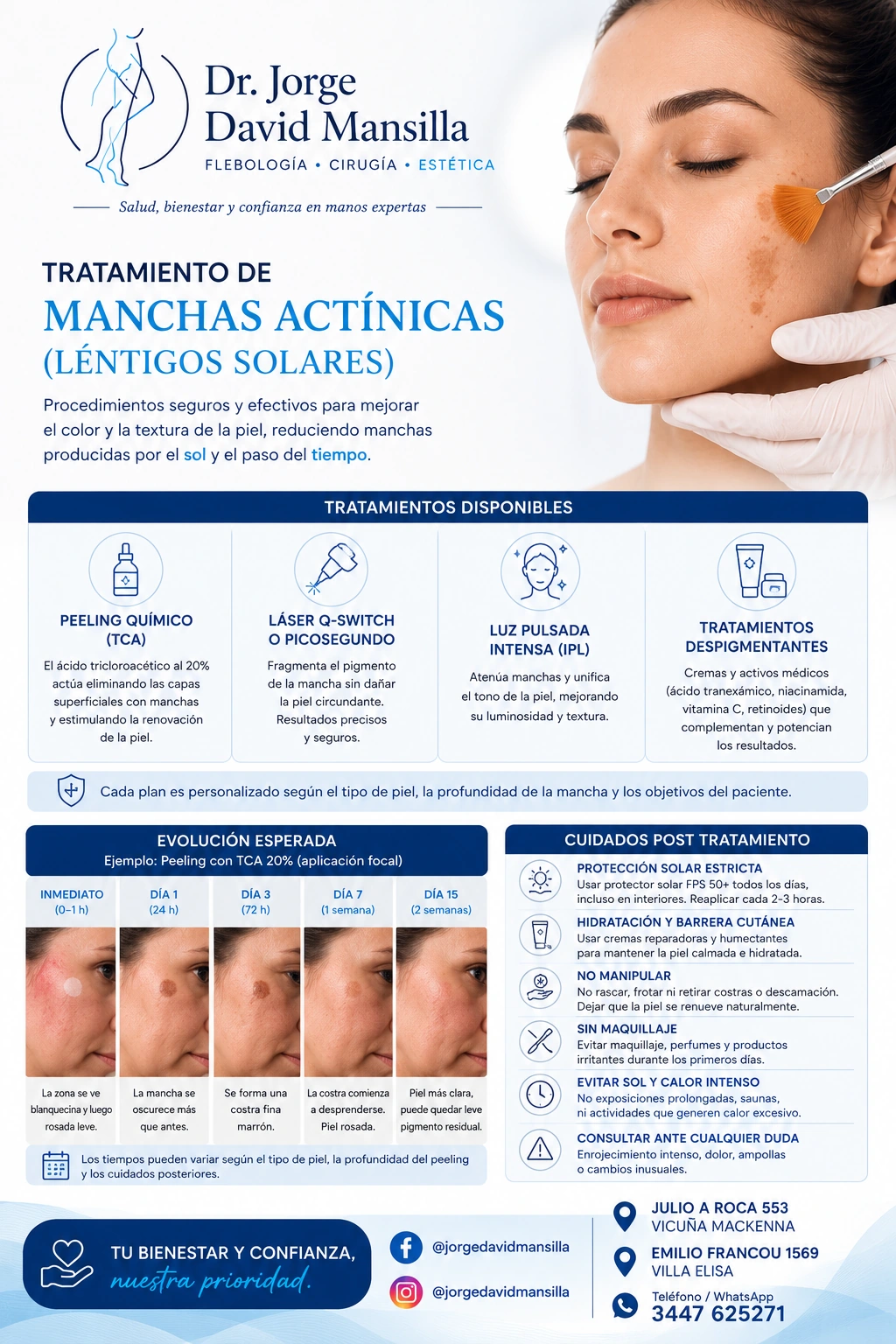 Manchas actínicas